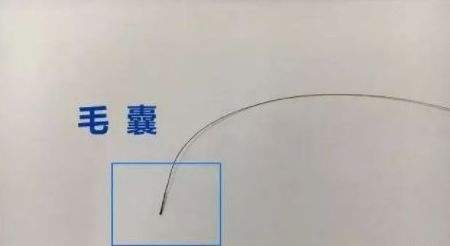 深圳親子鑒定用毛發(fā)鑒定準嗎