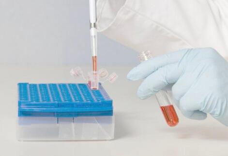 無創DNA鑒定怎么做