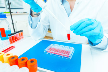 樣本會影響親子鑒定費用嗎 樣本會影響親子鑒定費用嗎