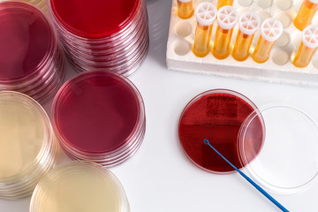 什么方法能跟孩子鑒定 什么方法能跟孩子鑒定